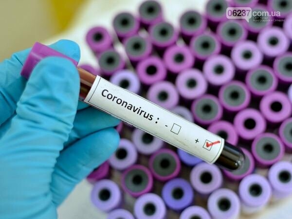 Донецкая область не получит тест-системы для выявления коронавируса, фото-1