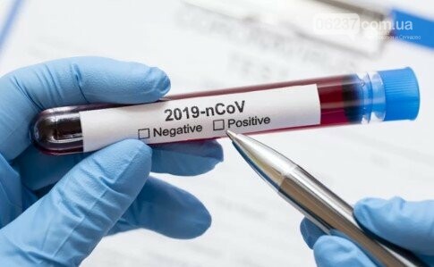 В Украине выявили уже почти 900 зараженных коронавирусом, фото-1