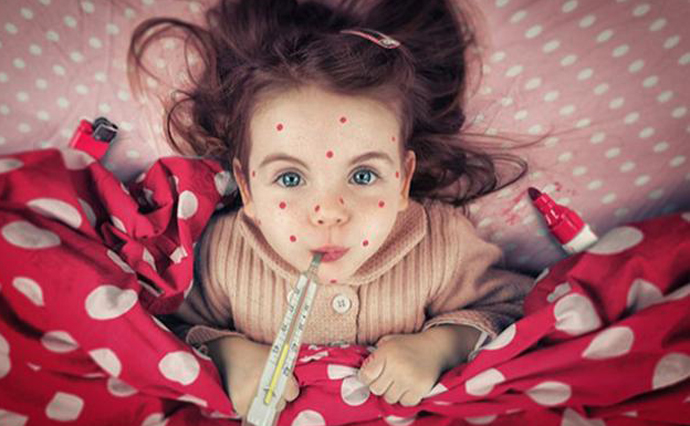 Увага! Кір в нашому місті!!!