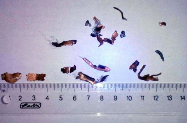 На Донетчине взорвался неизвестный предмет, пострадали трое детей